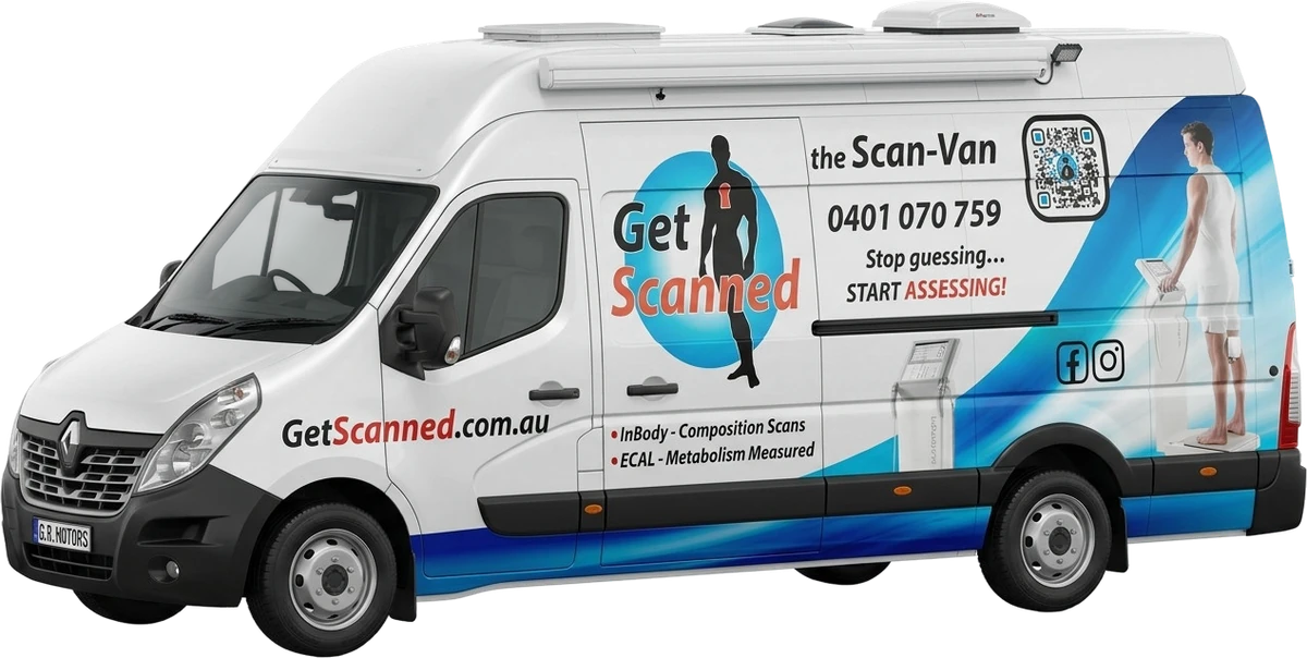 The Get Scanned Scan-Van
