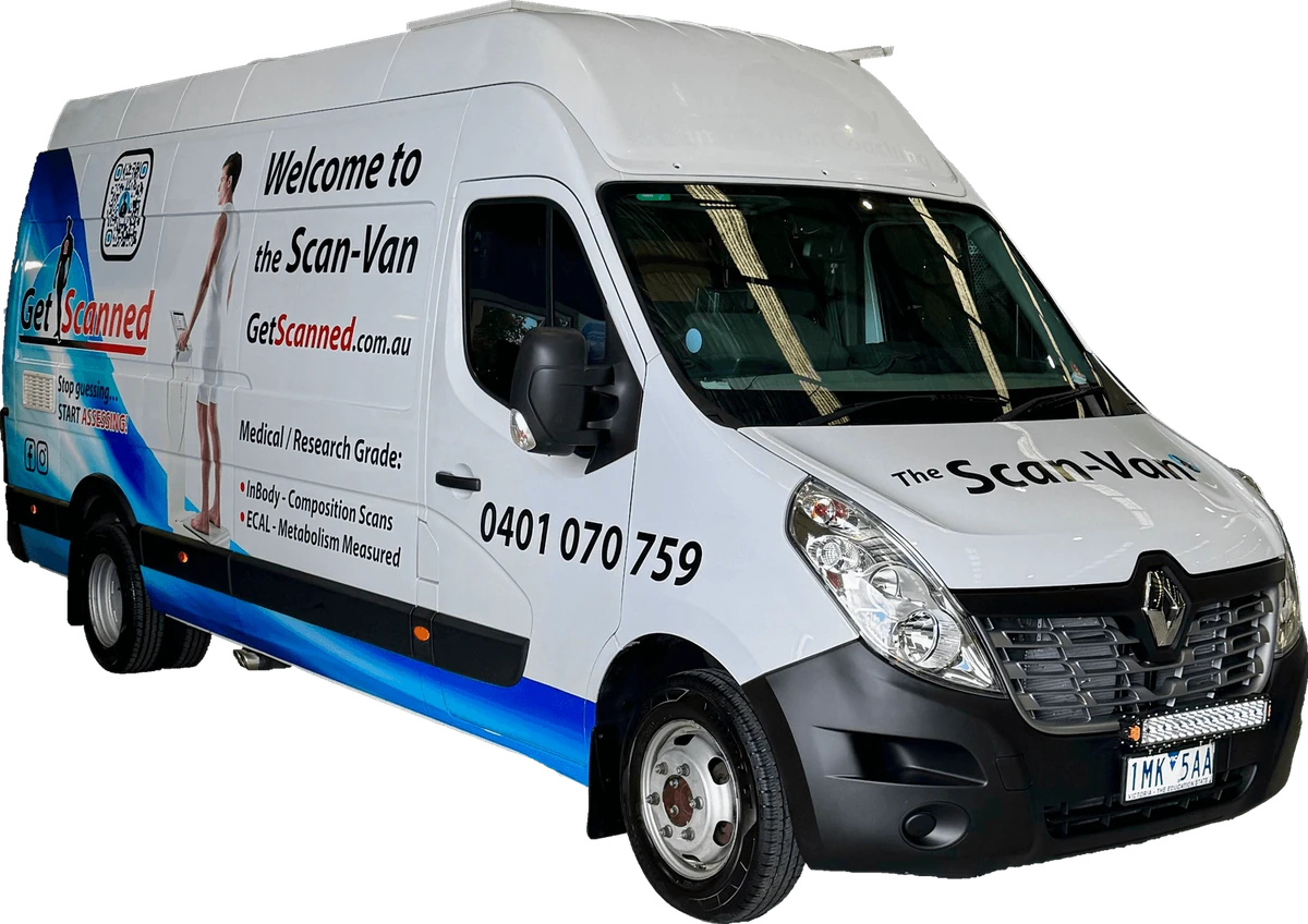 The Get Scanned Scan-Van