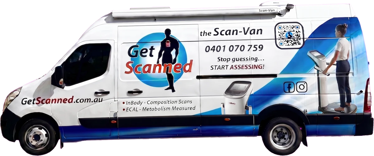 The Get Scanned Scan-Van